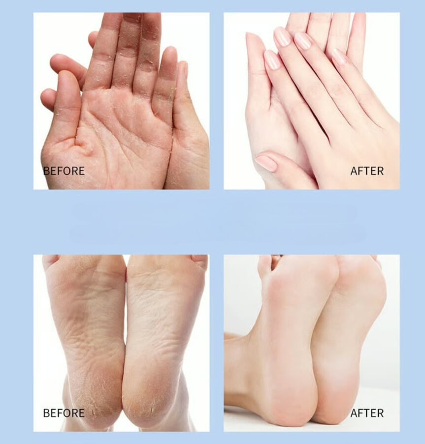 Ultra-Hydrating Foot Cream