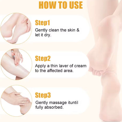 SoleBloom 60% Urea Foot Repair